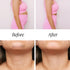 Namyaa Skincare PCOD and PCOS Ayurvedic Kit