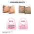 Thriveco Goodbye Acne Trial Kit