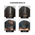 Thriveco Dandruff Treatment Trial kit
