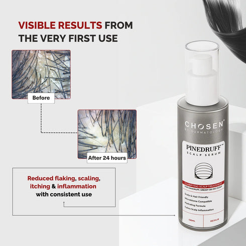 Chosen Pinedruff™ Scalp Serum