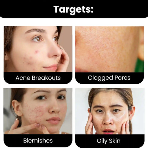 Thriveco 2 Salicylic acid Serum