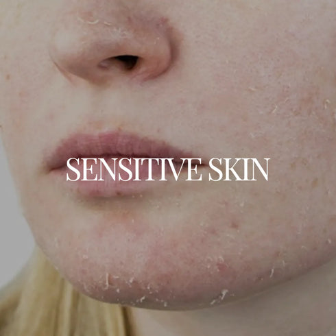 Natuur Regimen For Sensitive Skin