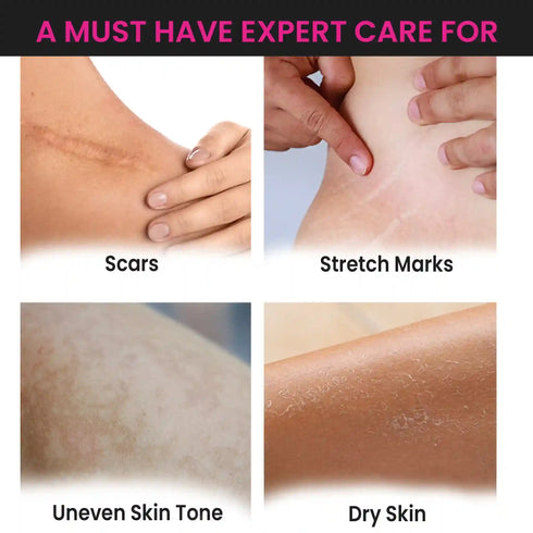 Thriveco Stretch Marks Trial Kit