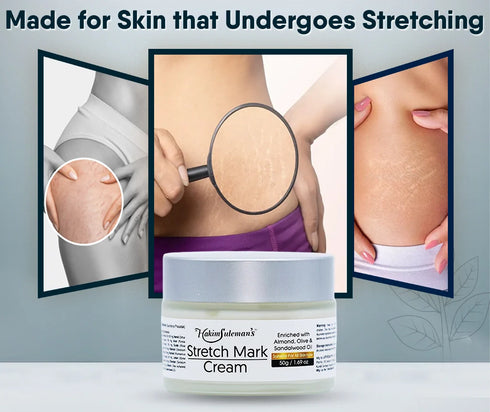 Atiya Herbs Stretch Mark Cream