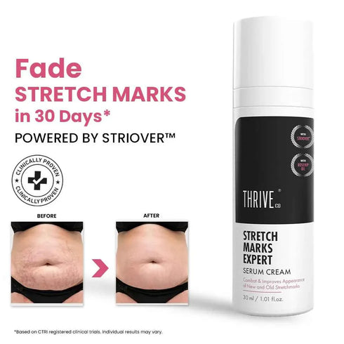 Thriveco Stretch Marks Expert Serum Cream