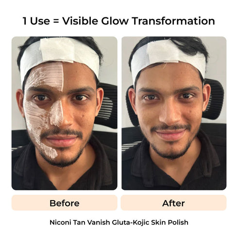 Niconi Ultimate De-Tan Combo for Men