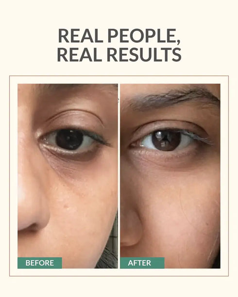 AreoVeda Under Eye Serum - 10ml