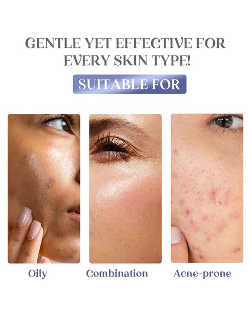 Healing Pharma ACNETOP Ultra Foaming Face Wash