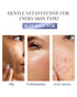 Healing Pharma ACNETOP Ultra Foaming Face Wash