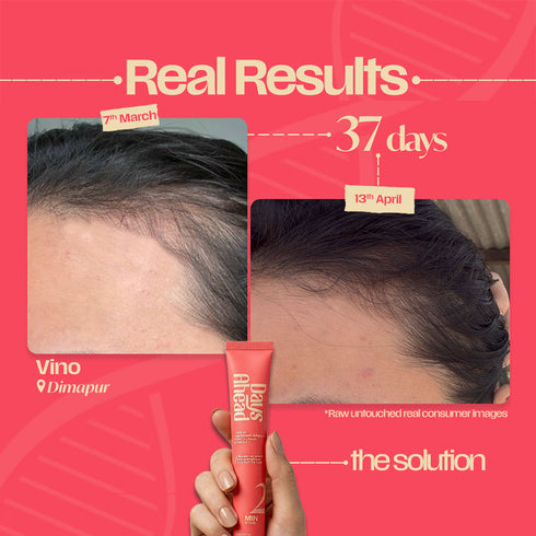 Days Ahead Leave-in Hair Growth Ampoule Serum (Roll on)