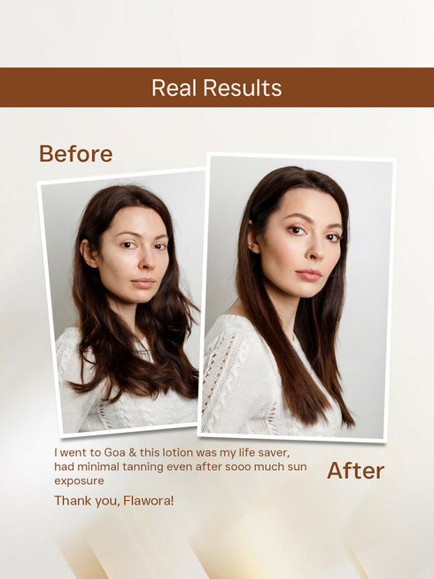 Flawora D-Tan Lotion|Anti Acne Serum And Gold Face Serum Combo