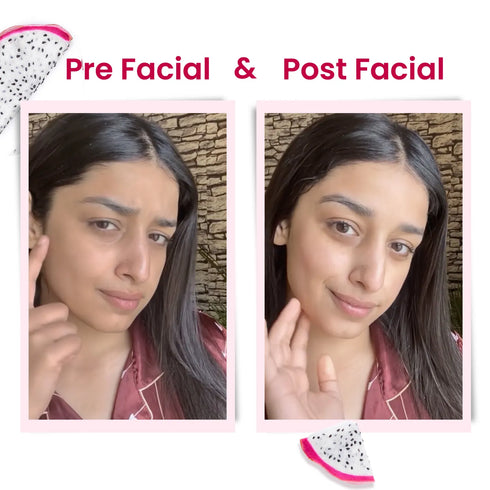 Alps Goodness Dragon Fruit Brightening Facial Kit