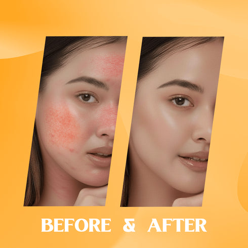 Healing Pharma Azelax Azelaic Acid Cream