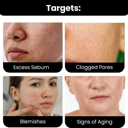 Thriveco 10 Niacinamide Serum with 1 Zinc PCA