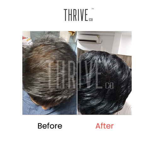 Thriveco Hair Care Kit ThriveCo Scalp Scrub Vitalizing Serum Hair Growth Serum
