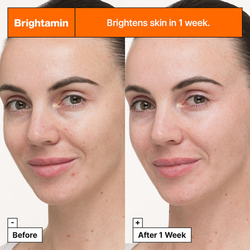 Dr.Jart+ Brightamin Brightening Serum Ampoule With Vitamin C and Niacinamide