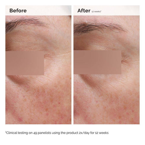 The Ordinary Niacinamide 5% Face & Body Emulsion