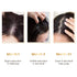 The Skin Story Anti-Dandruff Scalp Serum