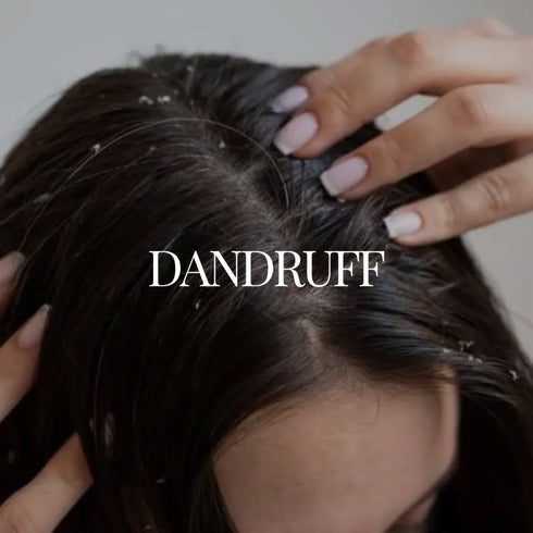 Natuur Kit For Dandruff Hair