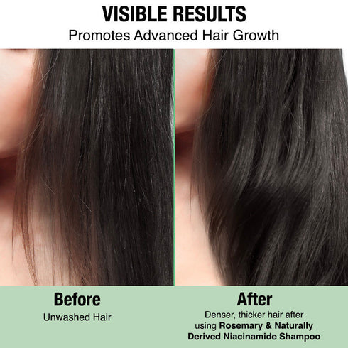 Nykaa Naturals Advanced Hair Growth Shampoo