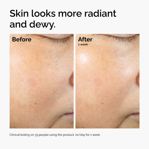 The Ordinary Rice Lipids + Ectoin Microemulsion Light Weight Face Moisturizer