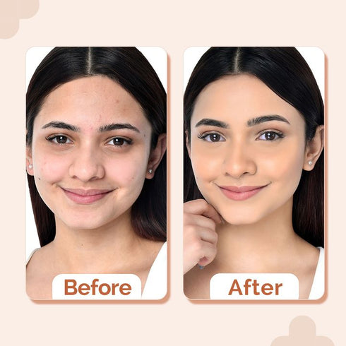 The Derma Co 2% Niacinamide High Coverage Foundation-01 Ivory