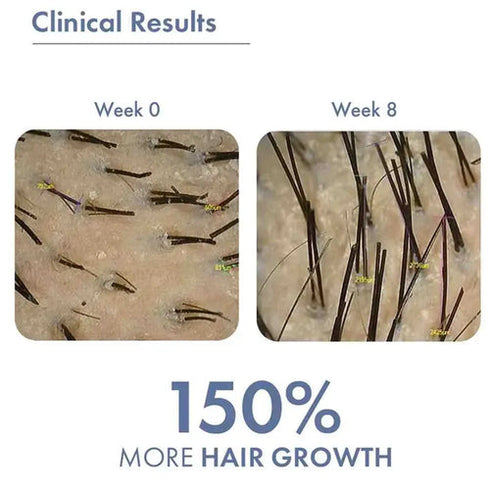 ThriveCo Hair Growth Serum 2.0