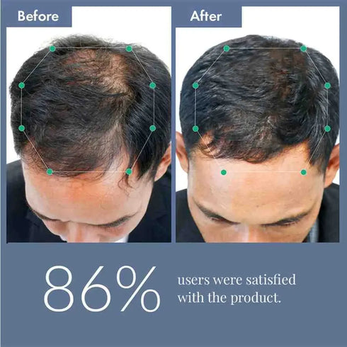 Thriveco Hair Growth Serum 2 0 For Men & Women