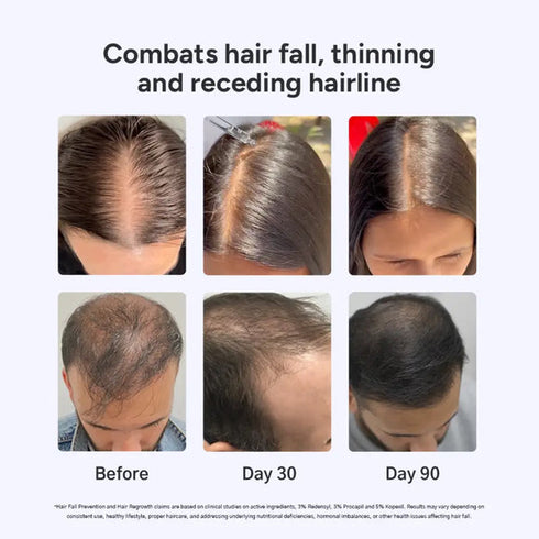 Arata Intensive Hair Growth Serum