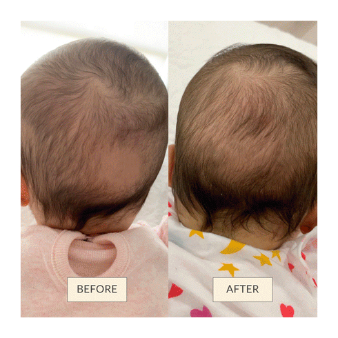 Omumsie Baby Hair Growth & Scalp Care Oil