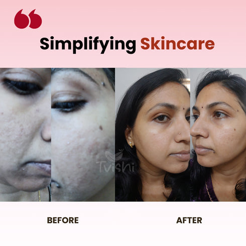 Tvishi Skincare Cleanser & Tint