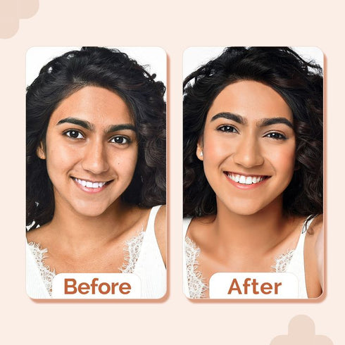 The Derma Co 2% Niacinamide High Coverage Foundation-04 Caramel