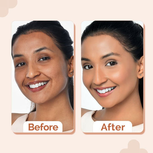 The Derma Co 2% Niacinamide High Coverage Foundation-07 Cinnamon