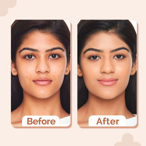 The Derma Co 2% Niacinamide High Coverage Foundation-05 Peach