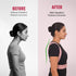 Wiselife Posture Corrector