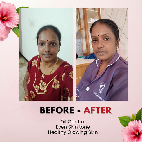 Tvishi Skincare Combination Skin Bundle