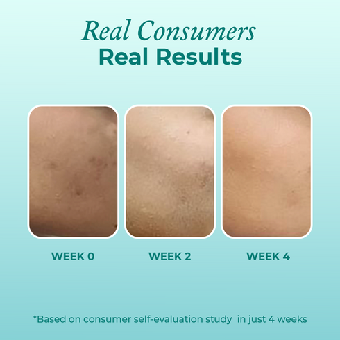 The Pink Foundry Mini Super Clarifying 12% Niacinamide Face Serum