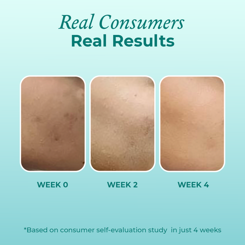 The Pink Foundry Super Clarifying 12% Niacinamide Face Serum