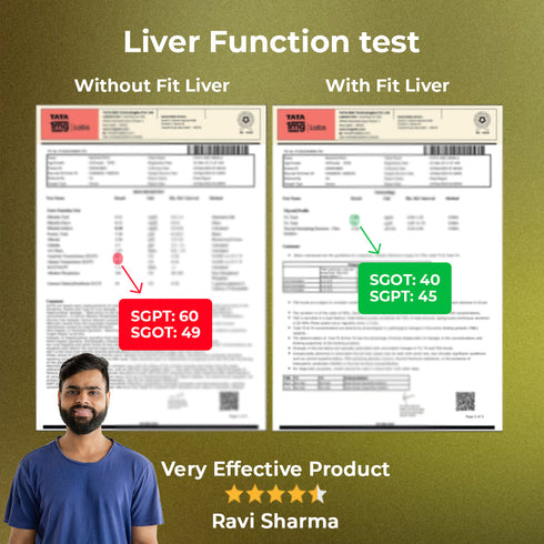 Fytika Healthcare Products Fytika Fit Liver Liver Detox Supplement Liver Detox with Milk Thistle Kalmegh Kutaki Kasani Haldi