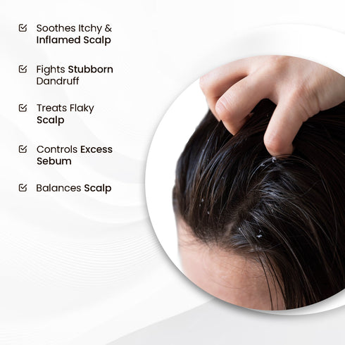 The Skin Story Anti-Dandruff Scalp Serum