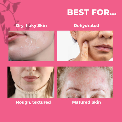 Tvishi Skincare Rose Moisturizer