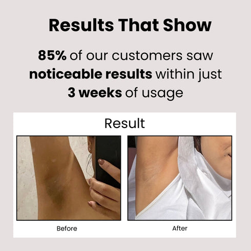 Milagro Beauty Natural Underarm Gel Mini