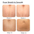 Thriveco Stretch Marks Trial Kit