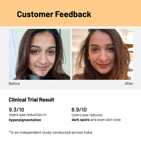 Innovist Hyperpigentation Control Face Serum