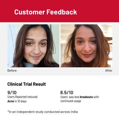 Innovist Acne Control Face Serum