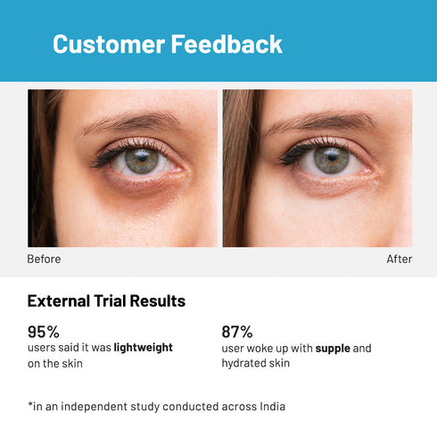 Innovist Hydrating and Anti Aging Under Eye Cream