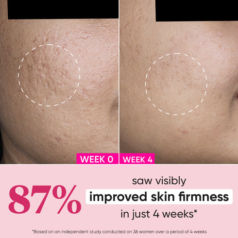 Dot and key Pomegranate + Multipeptide Anti Ageing Moisturizer Spf 30