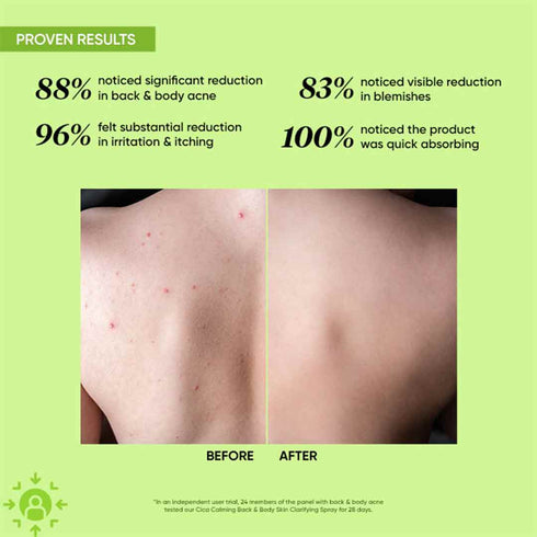 Dot and key Cica + 2% Salicylic Body Spray