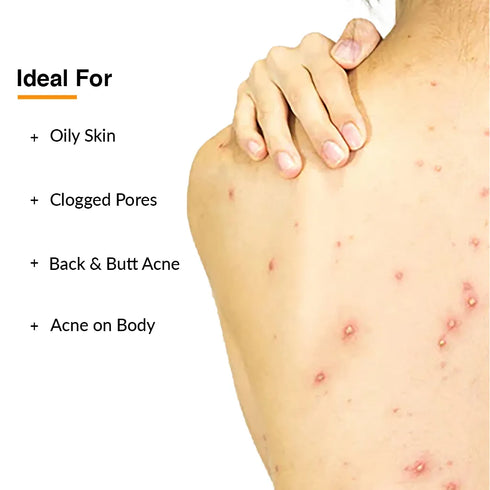 Fixderma Skincare Salyzap Body Wash For Body Acne | Salicylic Acid Body Wash