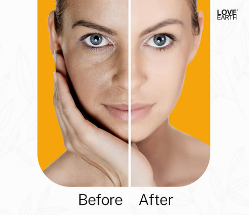 Love Earth Anti Blemish and Pigmentation Cream